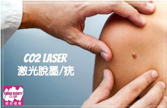CO2 Laser 激光脫癦/疣 (優惠已完結)